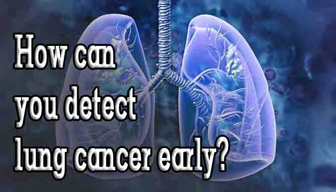 How can you detect lung cancer early?