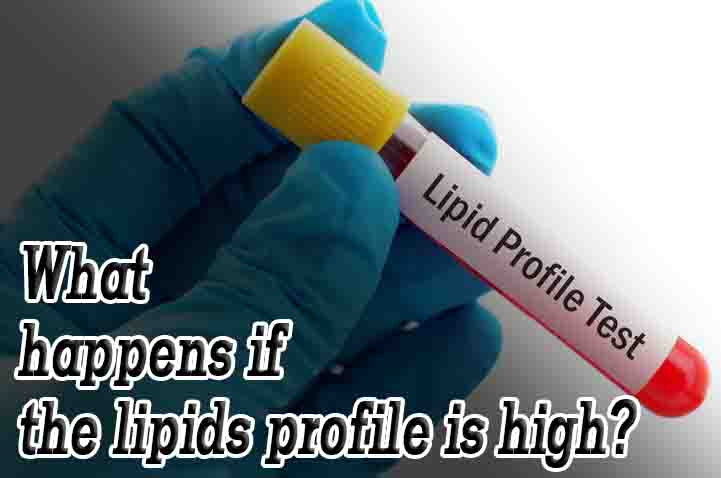 What happens if the lipids profile is high?